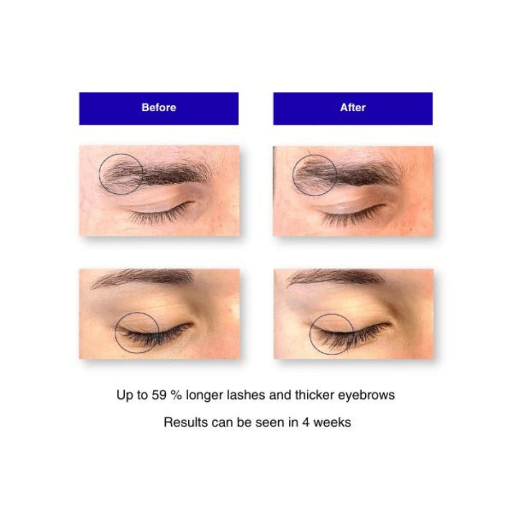 Before and after comparison of eye lashes and eyebrows with text indicating results.